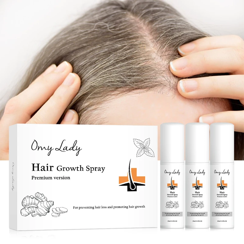 omy lady personalized packaging mild formula strong effect anti hair loss spray essence hair growth product