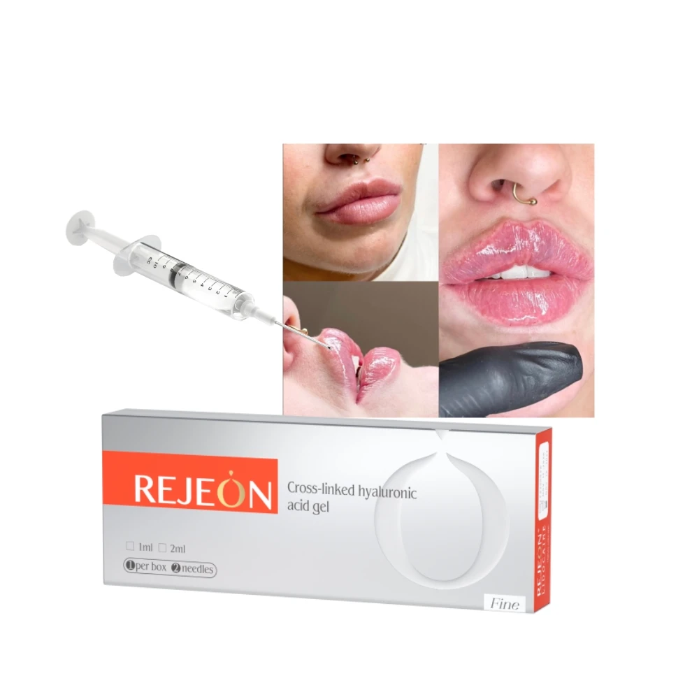 Neuramis HA Hyaluronic Acid Filler Dermal Filler Facial Filler for Forehead Nose Lips facial