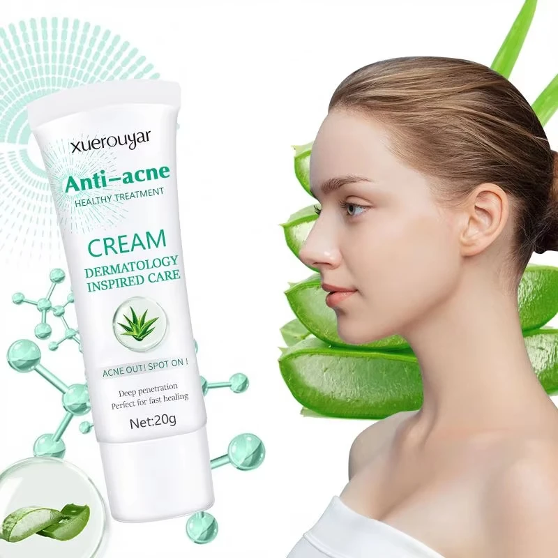 Skin Care Repair Pimples Acne Smooth Skin Shrink Pores Skin Moisturizer Gentle Anti Acne Whitening Aloe Vera Acne Face Cream