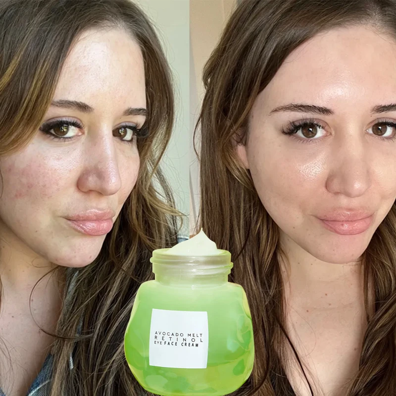 wholesale vitamin c retinol hyaluronic acid anti aging serum,private label skin whitening serum,avocado face serum
