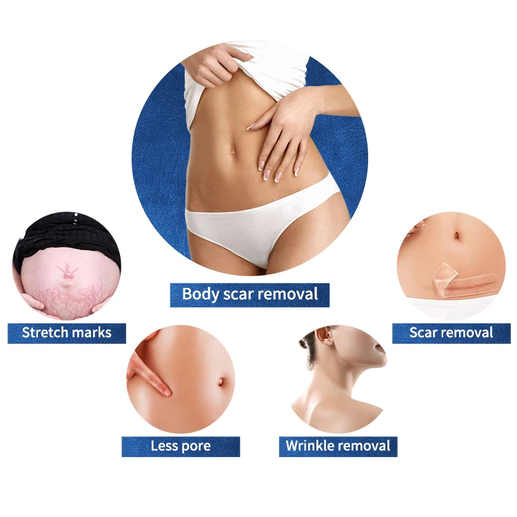 2023 Professional Microneedle Rf/Best Rf Skin Tightening Face Lifting Machine / Fractional Rf Micro Needle