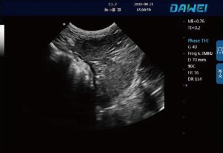 15 inch color LCD display/hard disk 128G/digital veterinary vet medical system dawei dw MU15 ultrasonography medical equipment