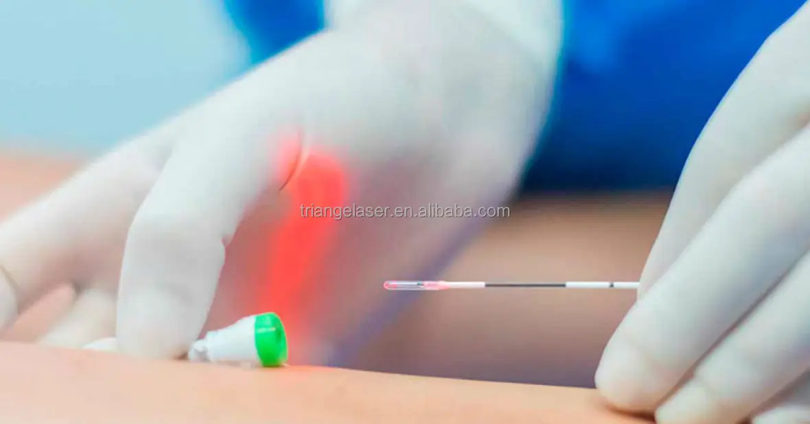 TRIANGELMED laser for varicose vein 980NM 1470NM vein laser endovascular laser machine