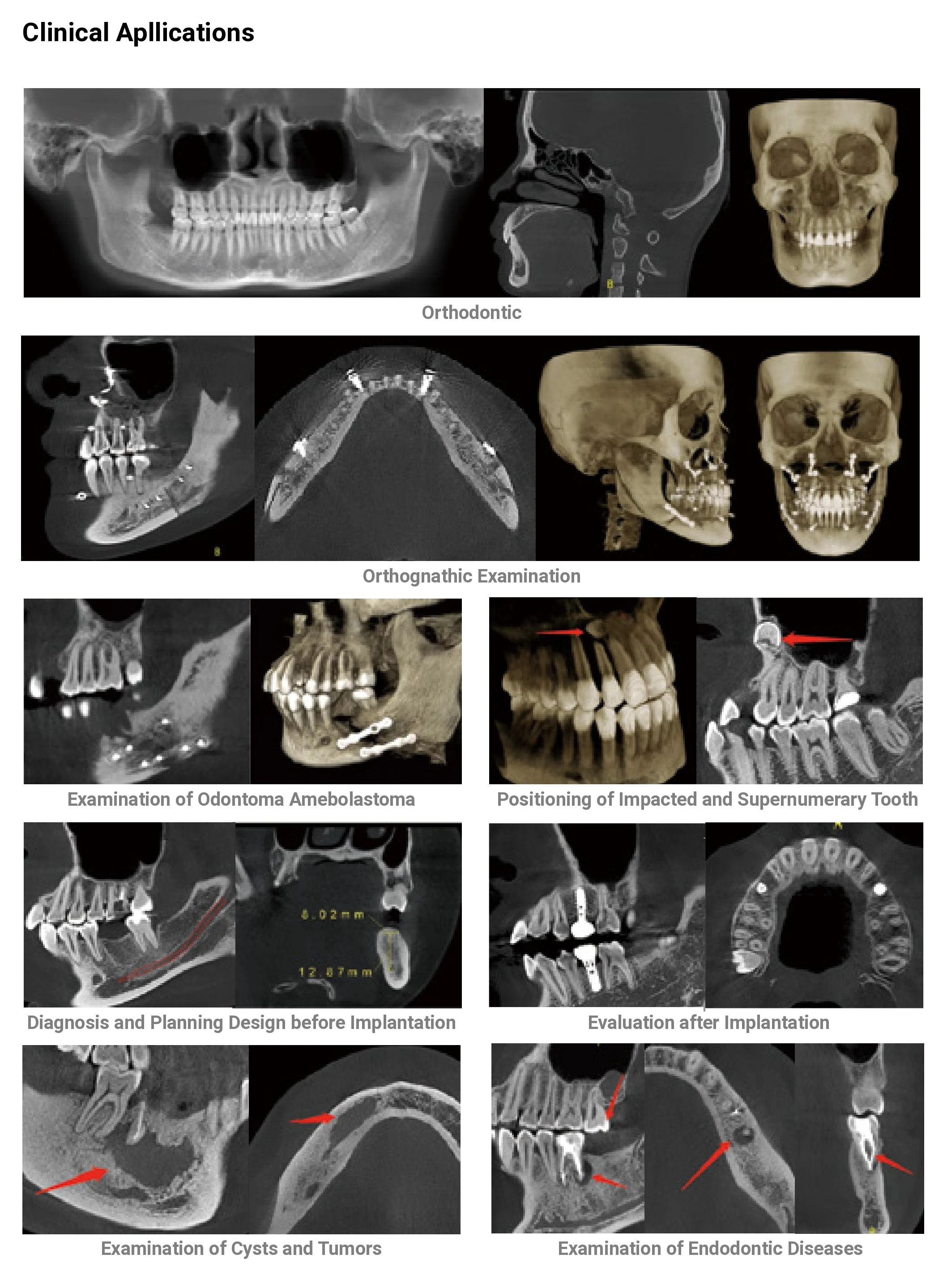 Hospital Dental Equipment Intelligent 3D CBCT Panoramic Imaging Machine Dental X-ray Machine