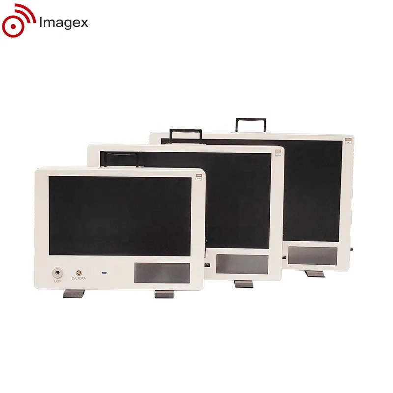 Affordable Compact Endoscope Camera System with Image Recording and Adjustable Monitor