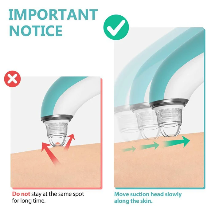 Portable Electric Facial Massage Acne Pore Blackhead Remover Vacuum Tool