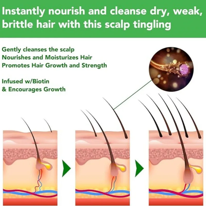 Own brand rosemary moisturizing shampoo long-lasting fragrance mint anti-dandruff anti-itch refreshing oil-control shampoo