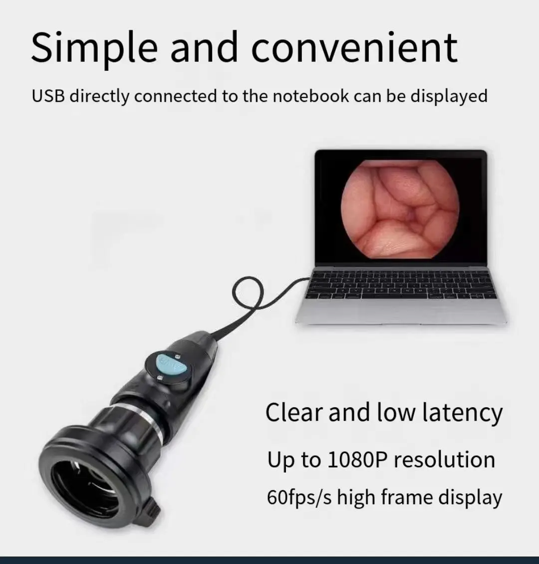 Medical New type HD portable mini ent endoscope usb camera/portable ent endoscope endoscope camera 2mp