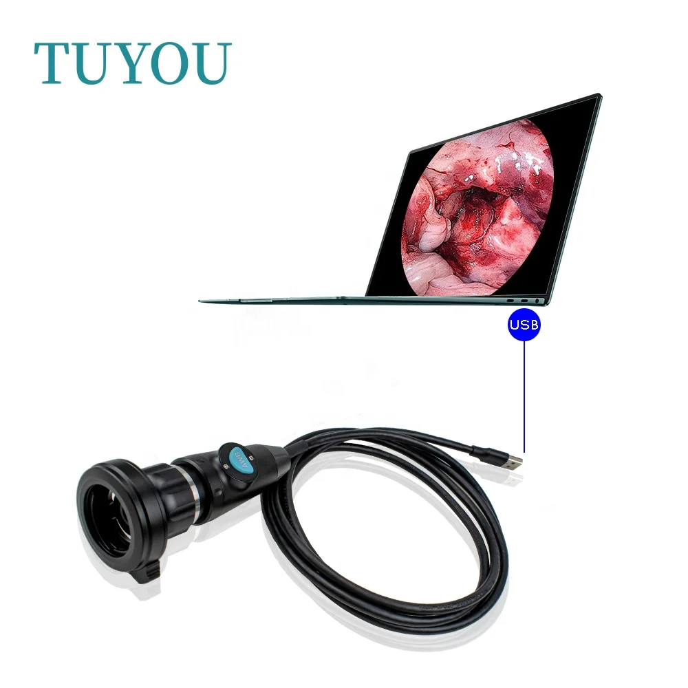 Hot Selling Portable Fhd Endoscope Camera System