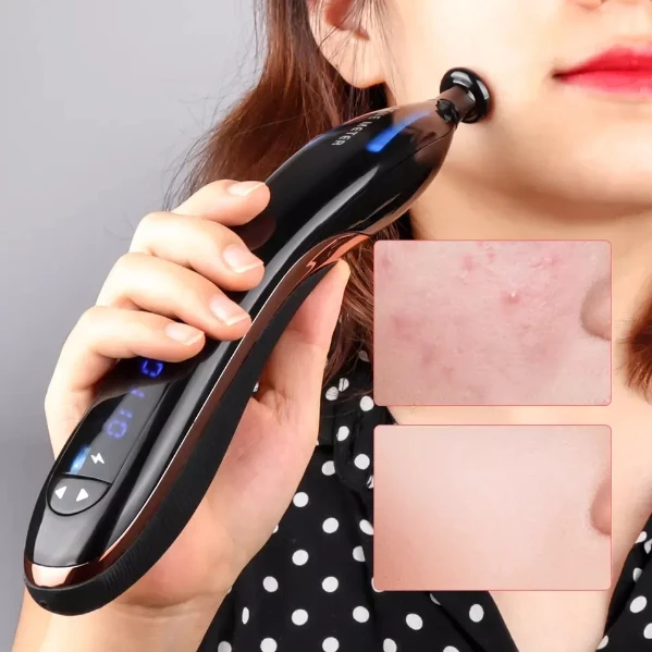 Most Popular Salon Spa Home Use Ozone Facial Machine Wand Acne Scar Removal Acne Treatment Plasma Pen Professional