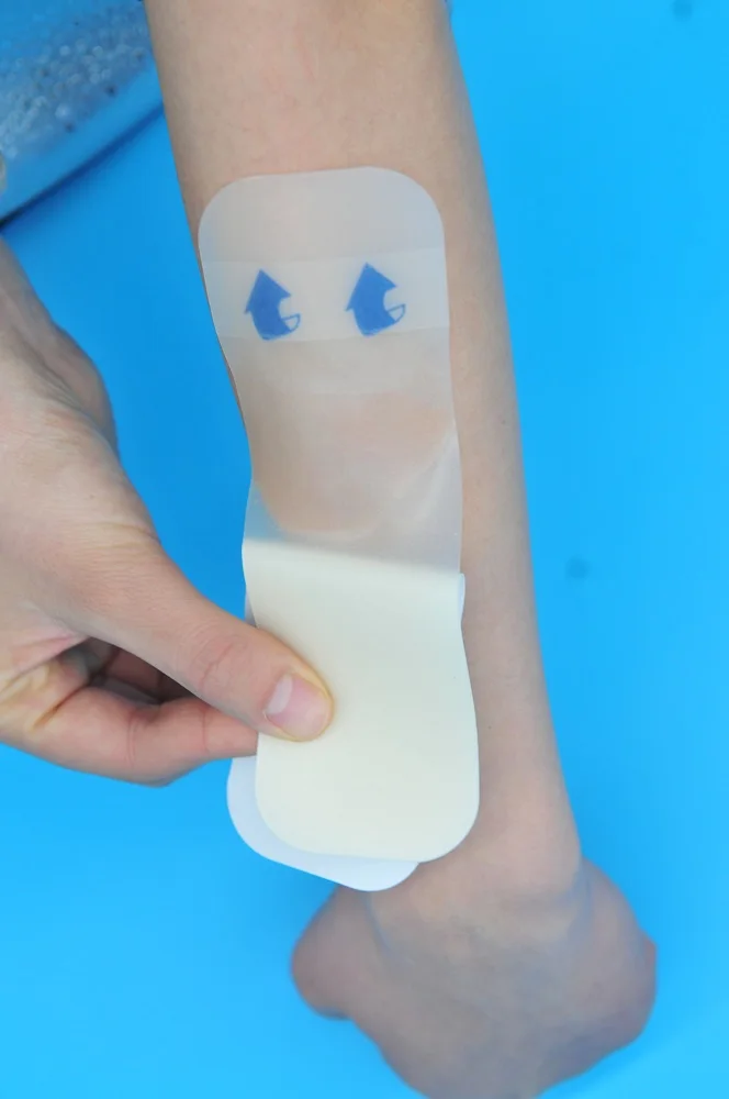 Ultra-thin Hydrocolloid Wound Dressing For Ulcer Wound Care Hydrocolloid Patch China Medical Hydrocolloid Dressing