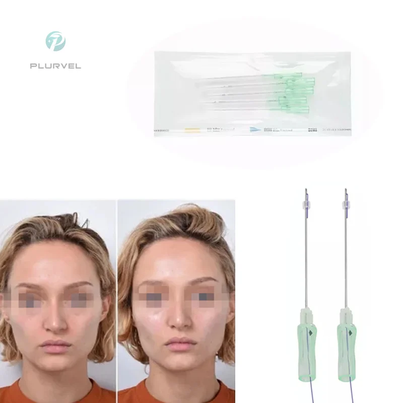 Cog thread 21G 60mm non surgical face lifting polydioxanone v lifting pdo thread suture with CE