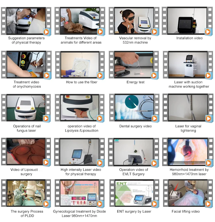 980nm High power 60w Lipolysis Laser for Fat Burning Cellulite Weight Loss