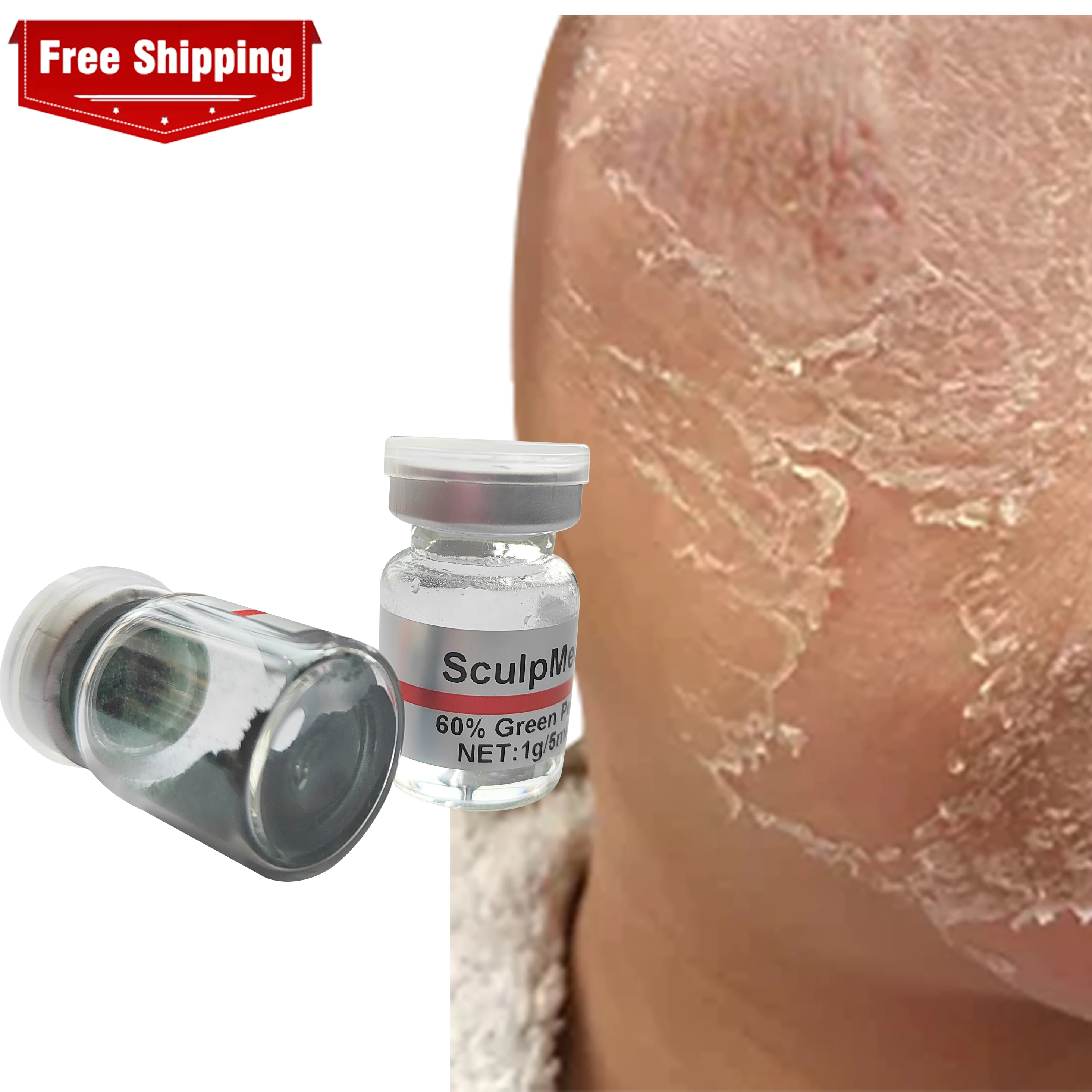 Green Algae Peel Bio Needles peeling Herbal 60% Face Peeling Bioneedling Spongilla Peel Powder