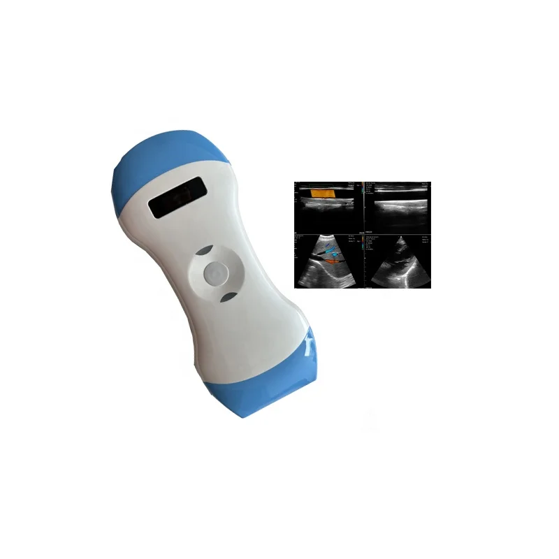 W8 Competitive price Portable wireless ultrasound probe scanner Double Head Mini Wifi Handheld Ultrasounder probe