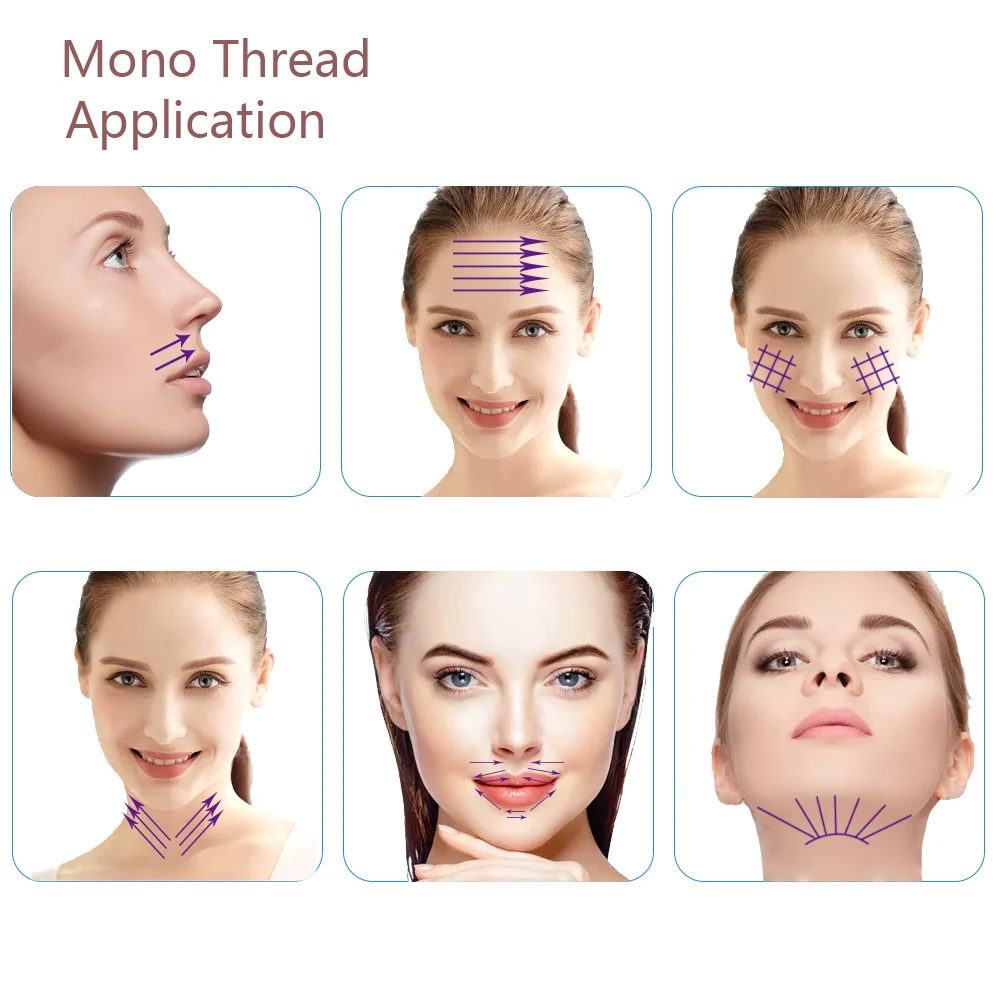 Factory Direct Delivery Medical Thread 26G 60mm Double Mono PDO for Wrinkle
