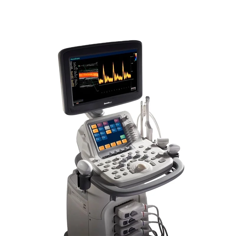 High Sensitive Vivid image Trolly Color doppler ultrasound Sonoscape S20 with probes and tranducers