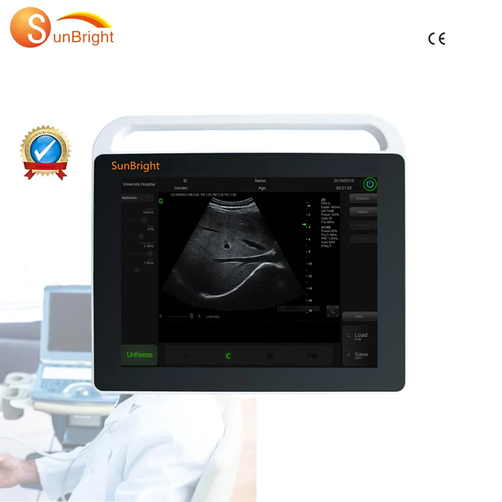 SUN-800S многофункциональная медицинская цифровой портативный ультразвуковой сканирующая