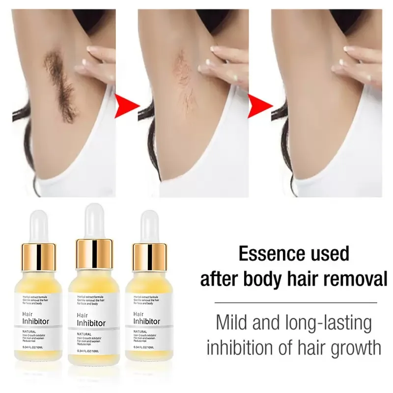 Hair inhibition mild Hair nourishing liquid 10ml dropper bottle