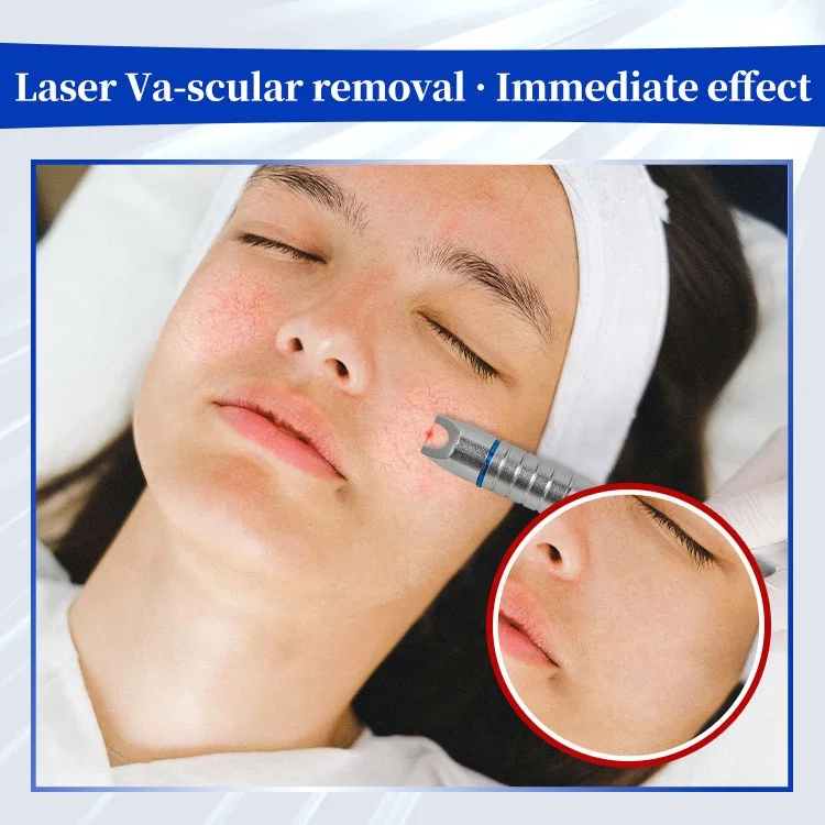 Non-invasive Blood Vessels Removal Laser Portable Diode Laser 980 Va-scular Removal Whitening Skin Rejuvenation Beauty Machine