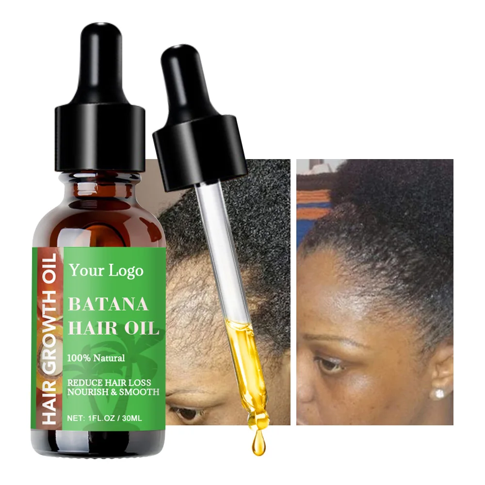 Private Label Wholesale 100% Pure Organic Hair Oil With Jamaican Black Castor,Nourish Hair Follicles Hair Growth Batana Oil