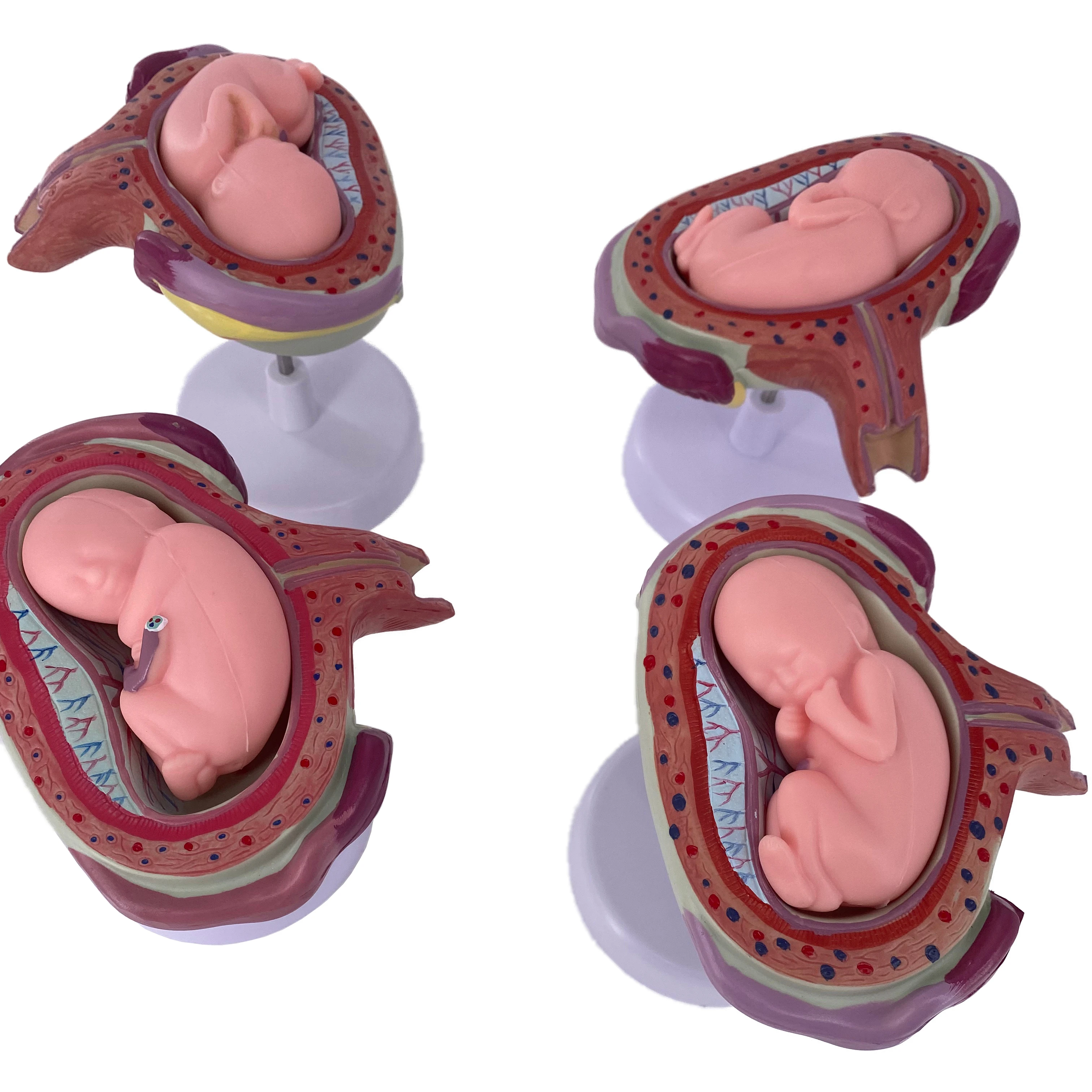 Pregnancy Development Model Female Anatomical Gestational Fetal and Embryo Medical Education Models for Medical Teaching