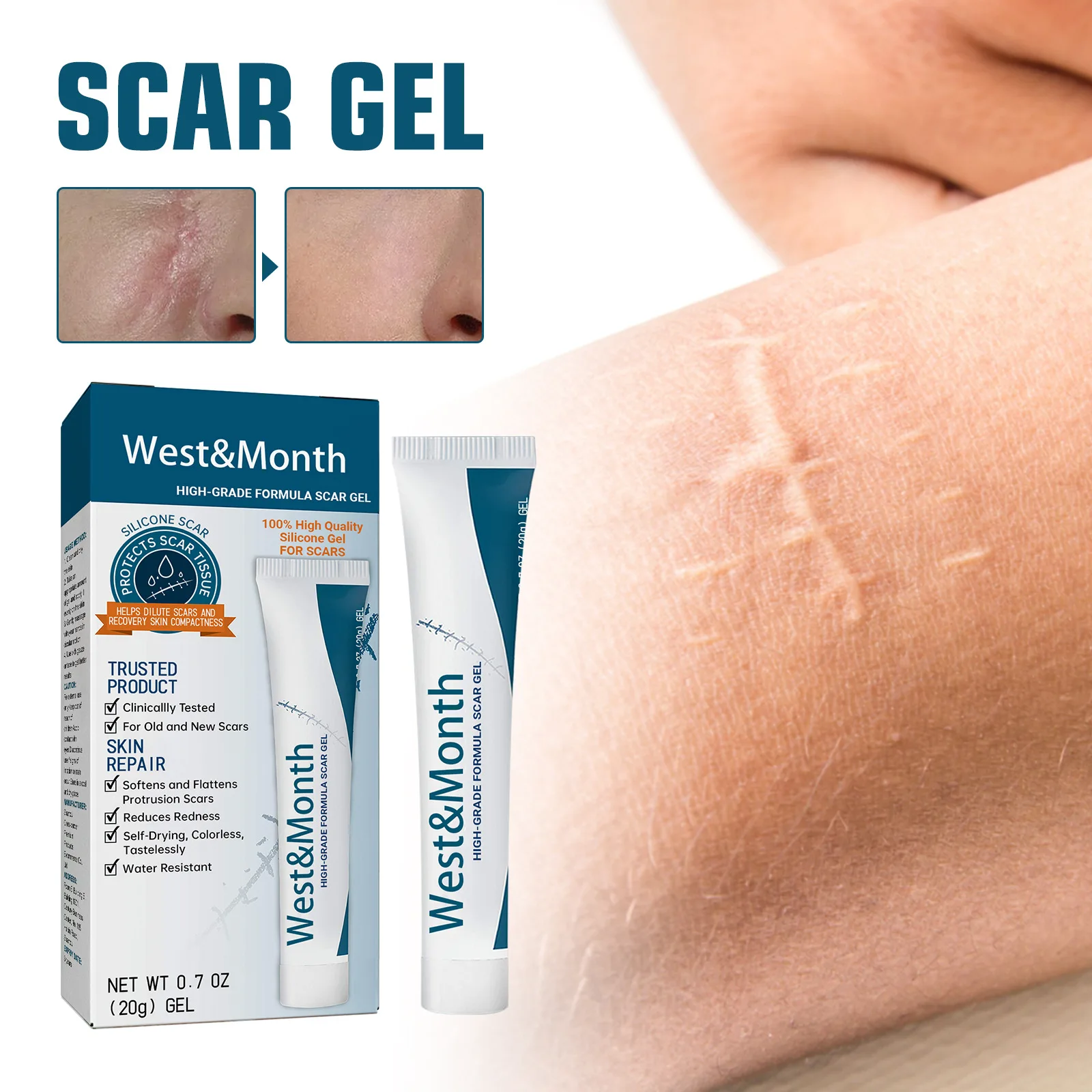 Popular product weakening scar gel scar repair cream for pregnancy scar removal surgery Customizable private logo