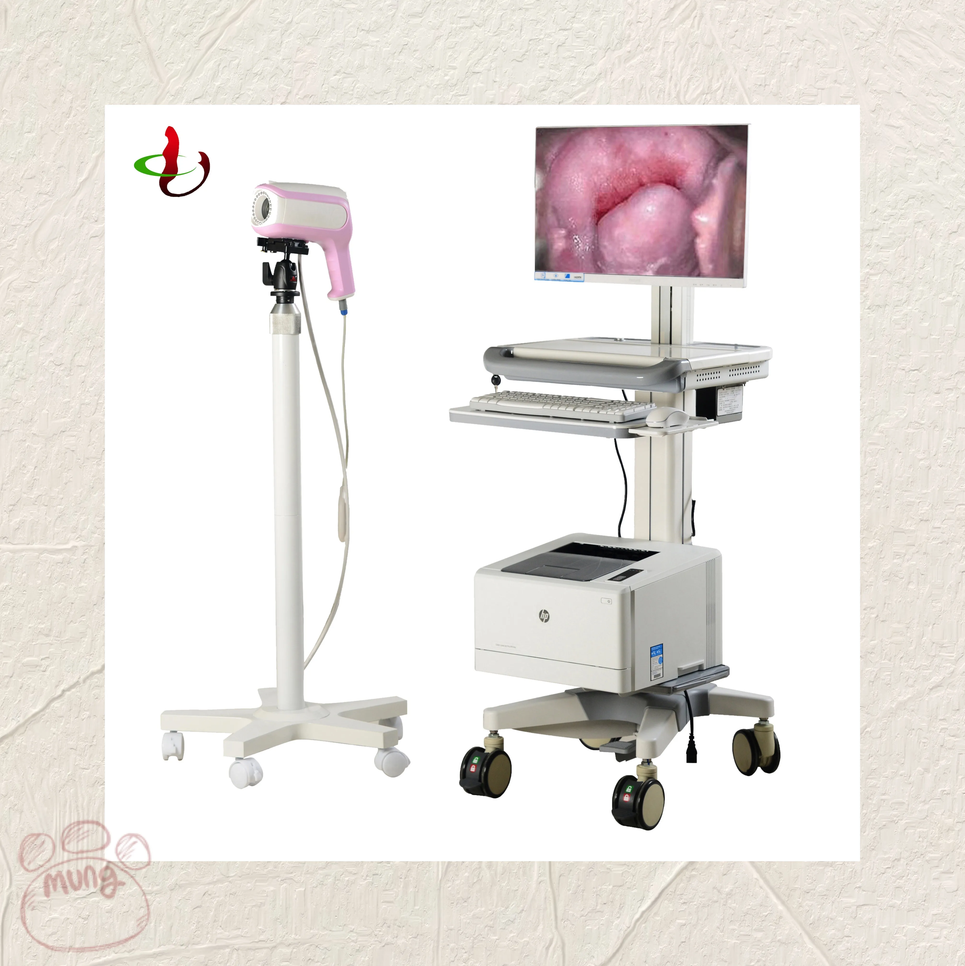 Portable vtype portable gynaecology equipment digital colposcope machine