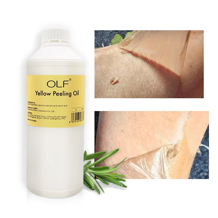 Wholesale High Quality Body Yellow Peeling Oil Lightening Glow Skin Bleaching Original Extra Strong Whitening Skin Peeling Oil