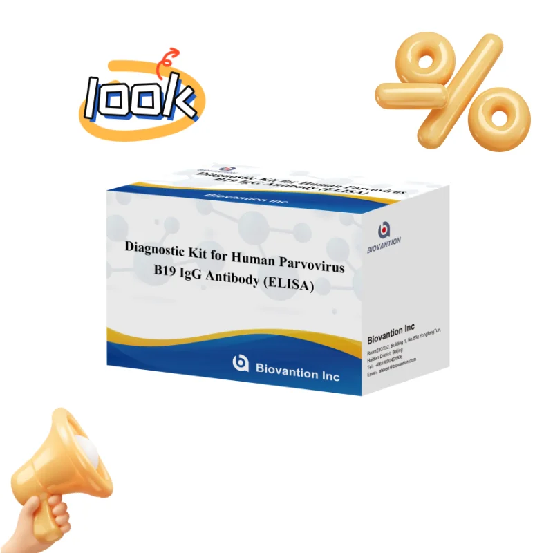 Elisa Diagnostic Kit for Human Parvovirus B19 IgM Antibody for hospital and lab