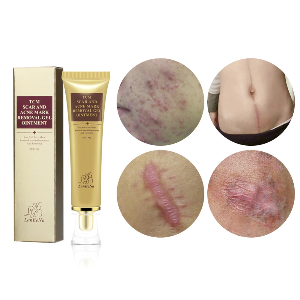 Professional effective quick customize Africa hot sale acne scar removal cream private label