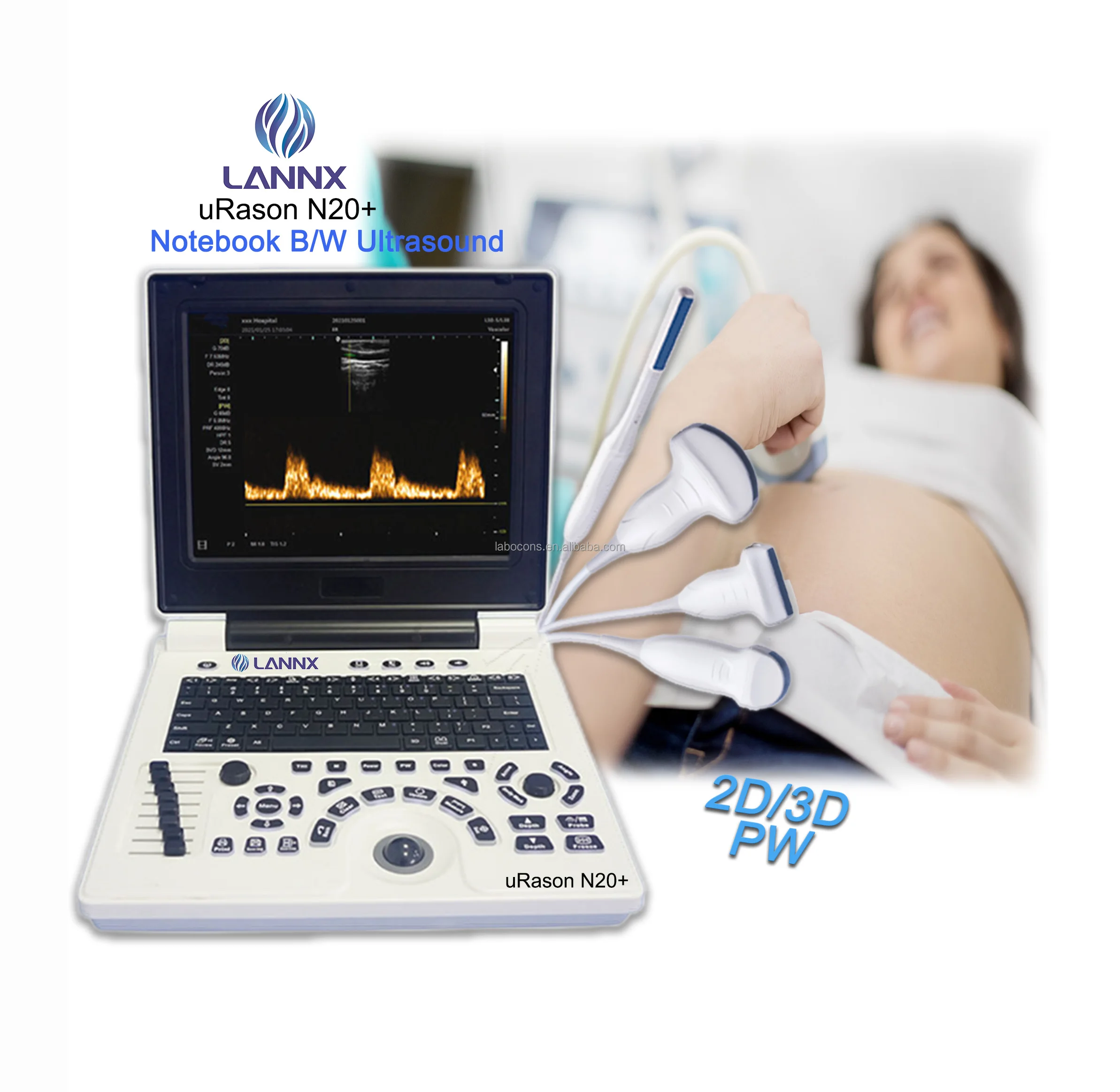 LANNX uRason N20+ Best Quality human Diagnosis echocardiography machine Medical pregnancy black / white ultrasound Instrument