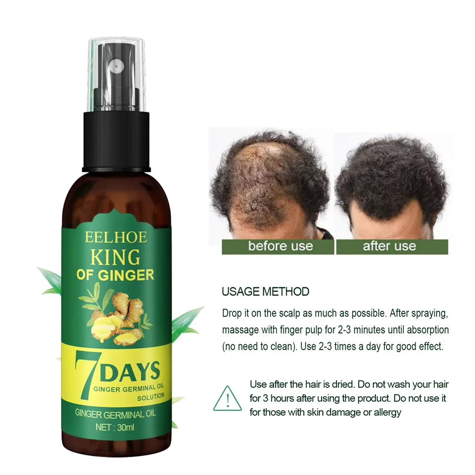 7 Days Ginger King Hair Growth Treatment Ginger serum Hair Loss Hair Treatment Oil Organic Germinal Serum