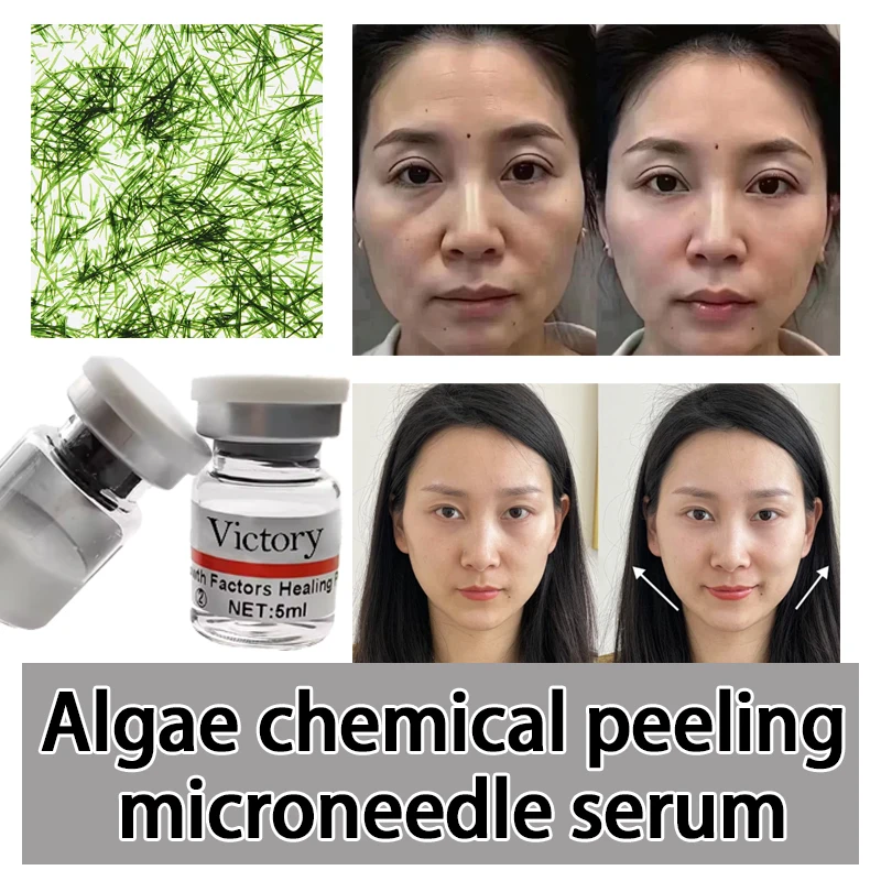 Epidermal Growth Factors Healing Power Human Korea Like For Post Algae Chemical Peel Microneedling Micro Needling Serum