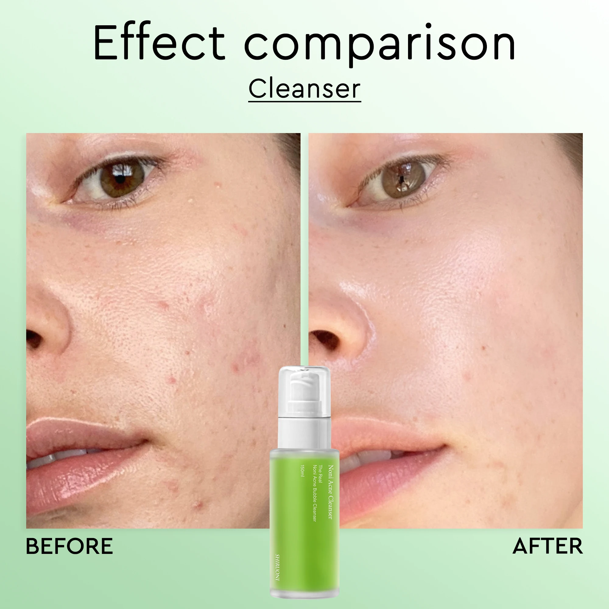 Private Label Noni Skincare Product Kit Vitamin E Boost Nourishing Toner Cleanser Serum Ampoule Moisturizing Noni Skin Care Set