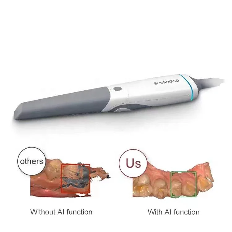 Dental Scanner Dental Consumables Intraoral 3d Scanner intra oral scanner
