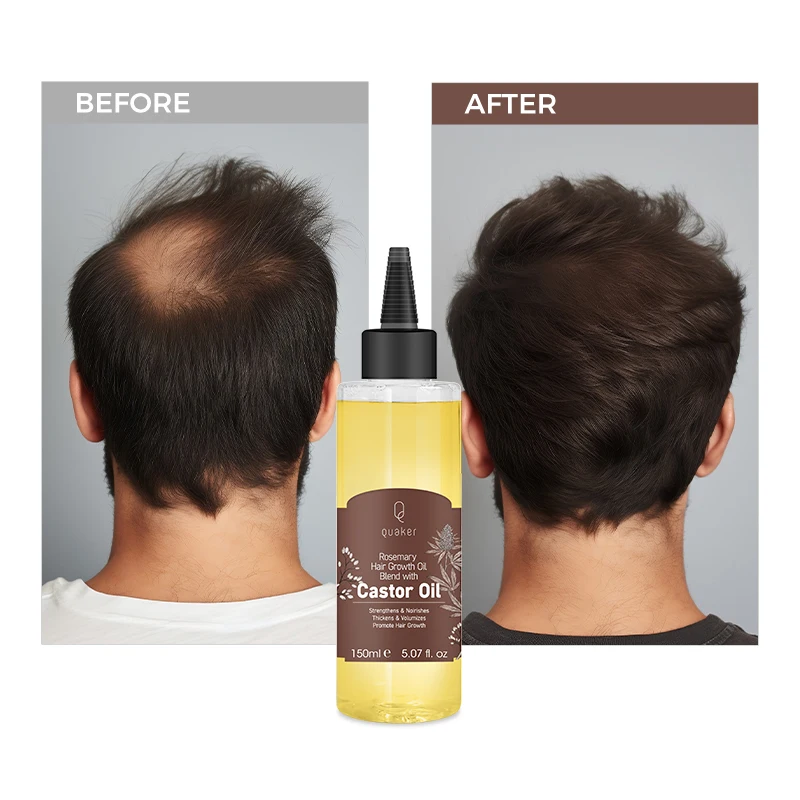 Qquaker 150Ml Private Label 100% Natural Castor Oil Hair Growth Oil Scalp Strengthening Anti Hair Loss