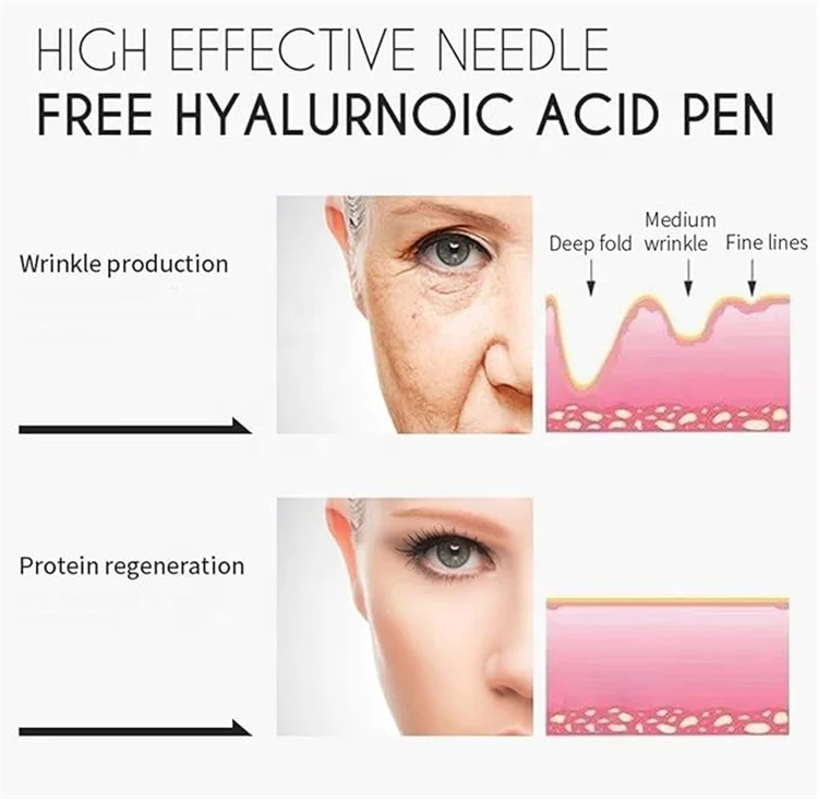 Hyaluron Pen (15).jpg