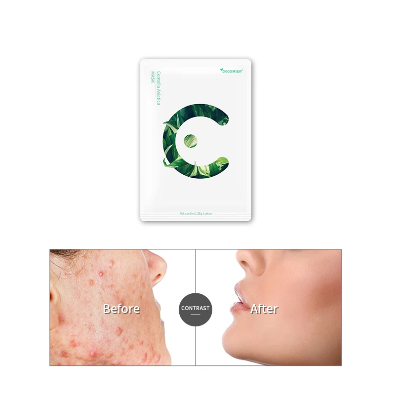 Wholesale acne anti-acne repairing skin centella asiatica nourishing and beauty facial mask for women