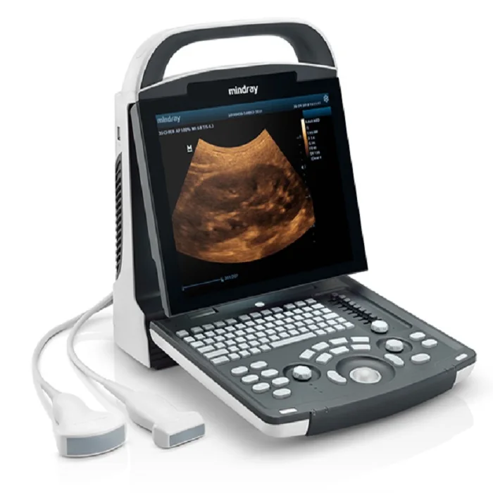 Dp-10 vet DP-10 Digital Ultrasonic Diagnostic Imaging System Ultrasound Scanner ecografo  dp10 ultrasonic power board