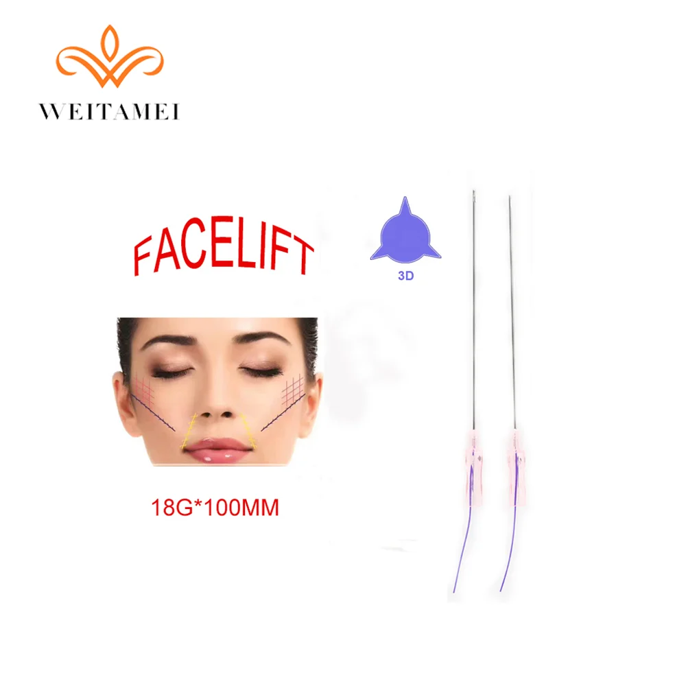 18g 100 мм W Cog 3D Pdo резьба для лифтинга лица высокого качества