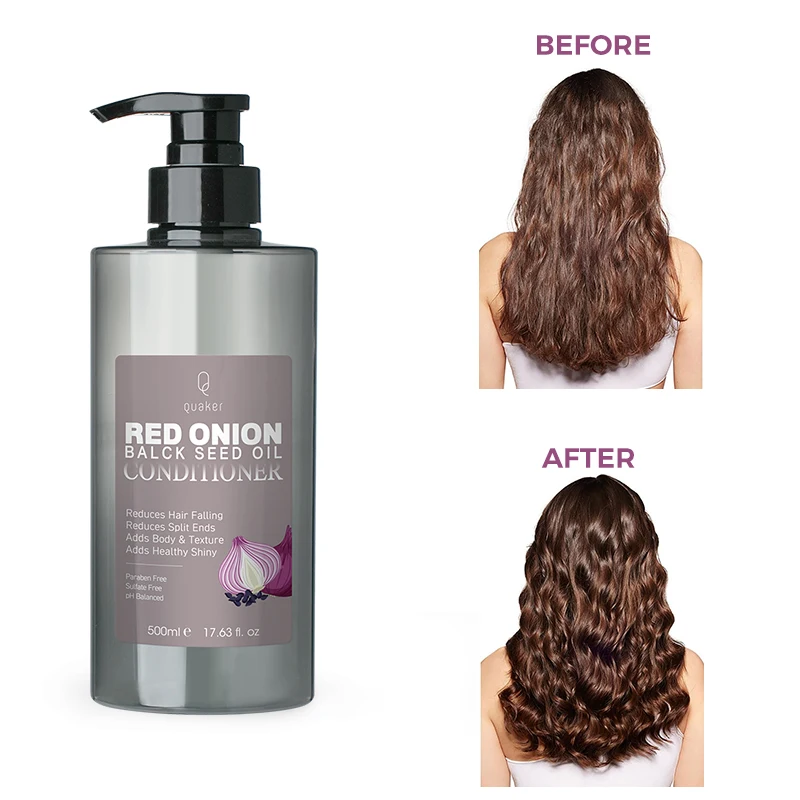 Brand Custom Plant Natural Hair Care Red Onion Black Seed Conditioner Hair and Shampoo