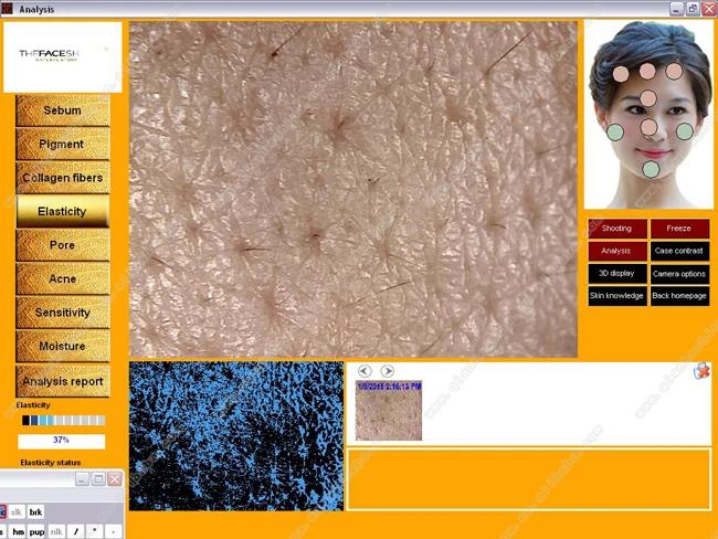 Hot sale visia skin analyzer machine with 14inch screen