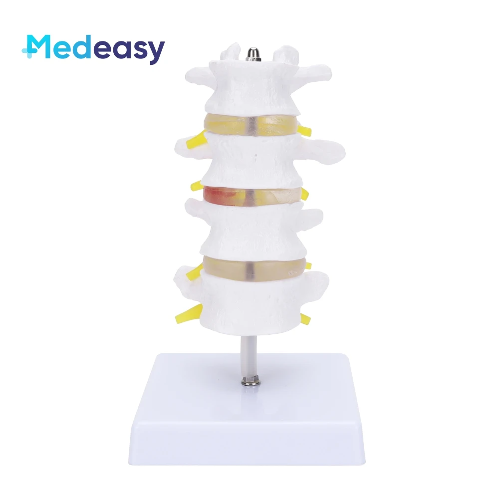 Four-section human lumbar spine model