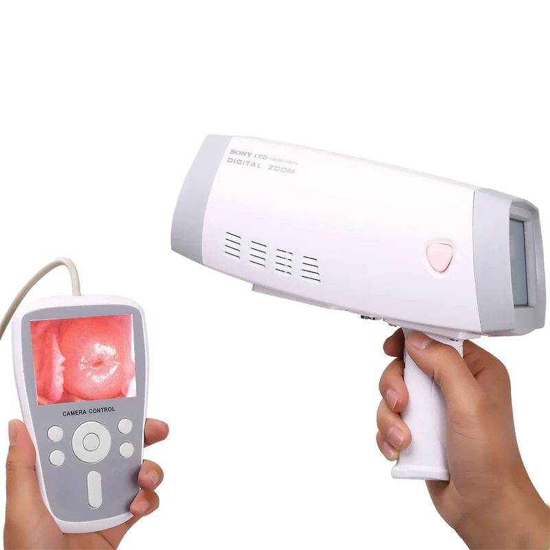 Недорогая портативная вагинальная камера Colposcopy, цифровая видеокамера Colposcope для гинекологии