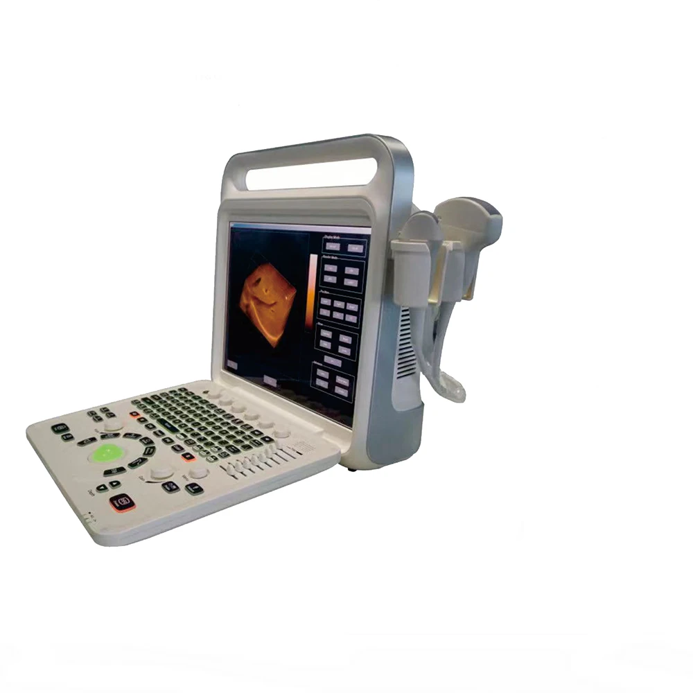 MHz 4D volumetric Portable notebook Color Doppler double probes ultrasound machine with 15 inches LCD monitor E60