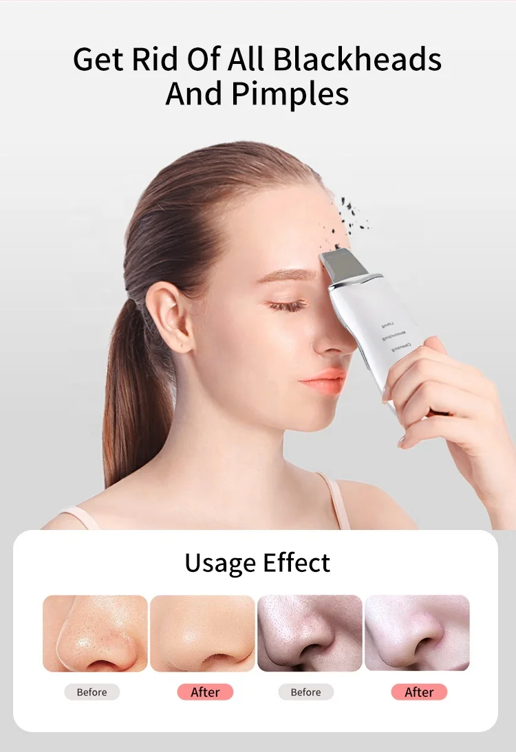 OEM Best Selling Products 2021 Electric Skincare Tools Ultrasonic Skin Scrubber Machine With Private Label