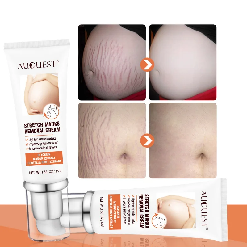 Glycerin Lightening Stretch Marks Improve Dullness Lifting Firming 45g Stretch Mark Cream