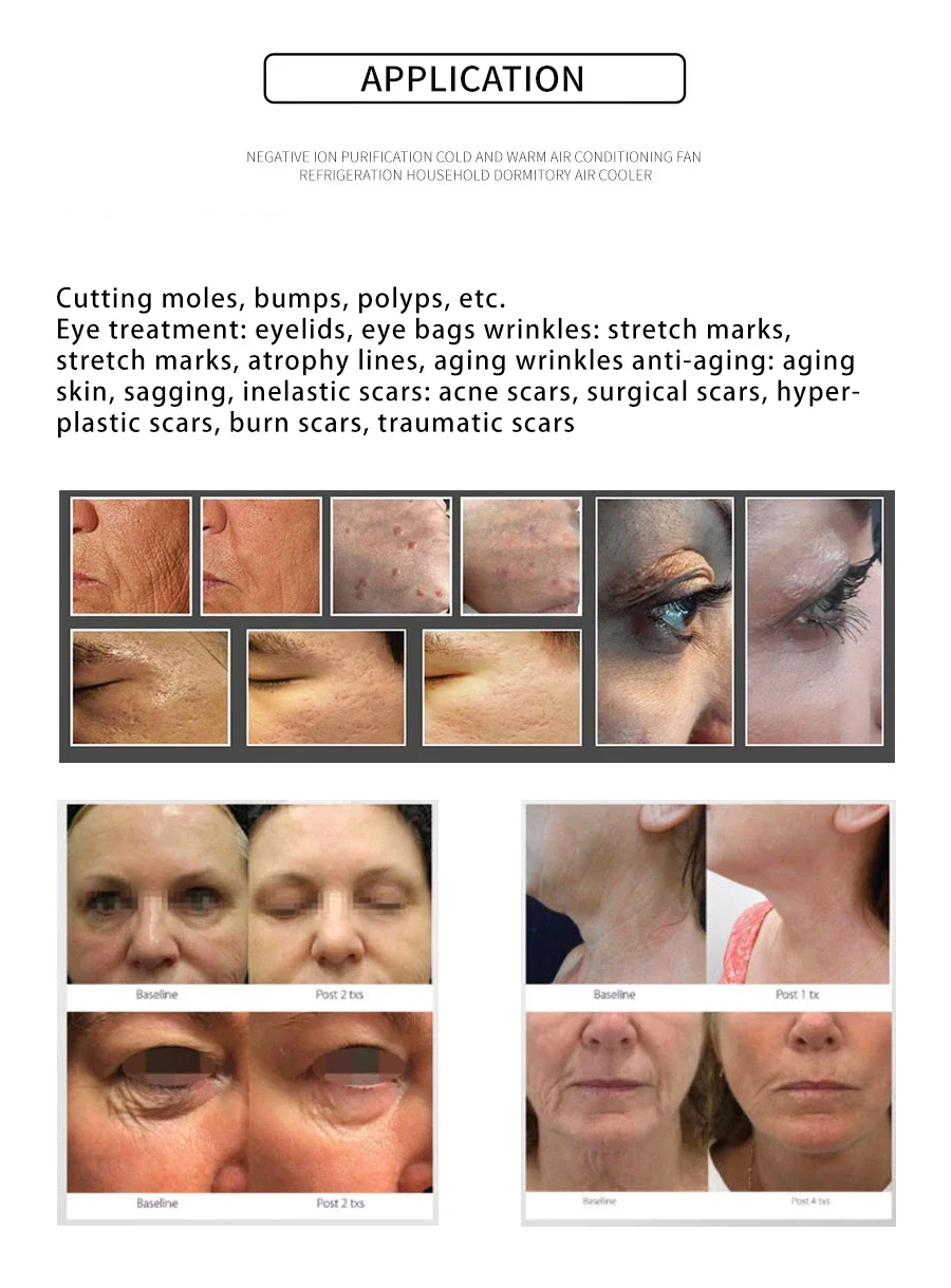 Newest 3 In 1 Fractional Jet Plasma Skin Machine / Ozone Ion Plasma Shower / Acne Plasma Pen Professional