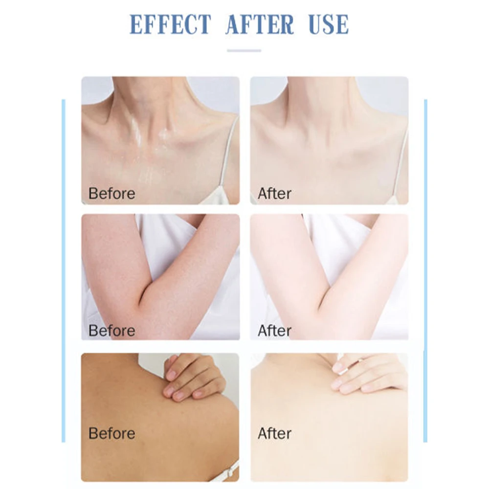 Frozen Collagen 2 in 1 Skincare Product Whitening Body Wash 5 Days Fast Action Kojic And Collagen Bath Soap